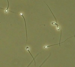 Human sperm viewed under phase contrast. Image is courtesy of the ABA